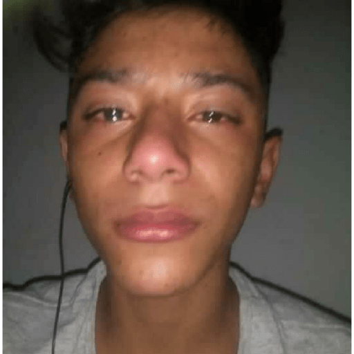 Noseque 1