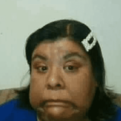Reacciones 11