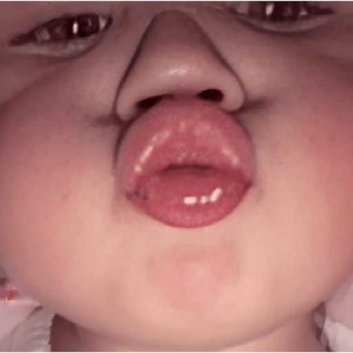 Bebês 🫶 2
