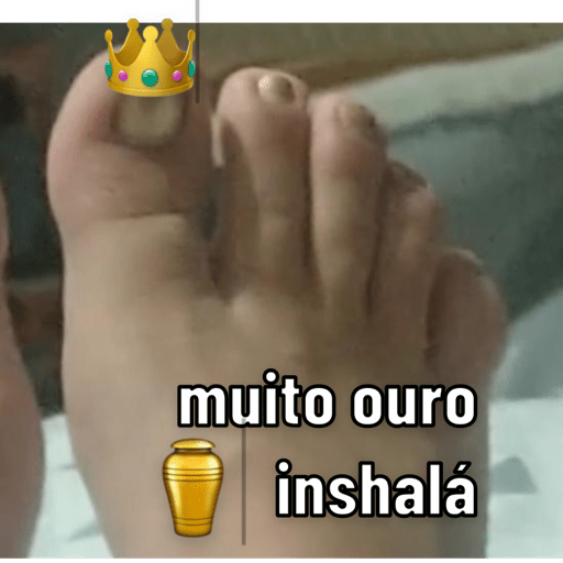 Aleatorios 2 26