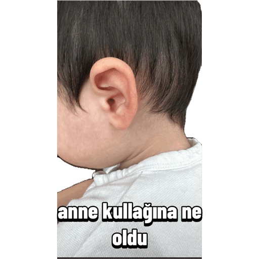Çalmaçıkartmalarımı 24