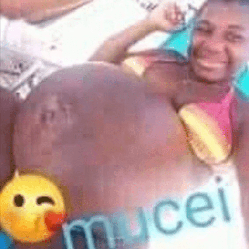 Anus 22