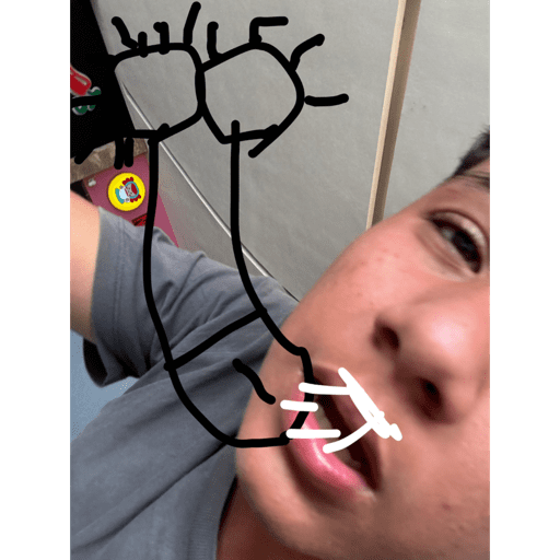 ñochelto 12