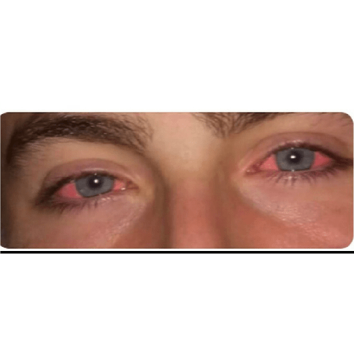 4:20 8