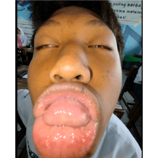 Kepo 19