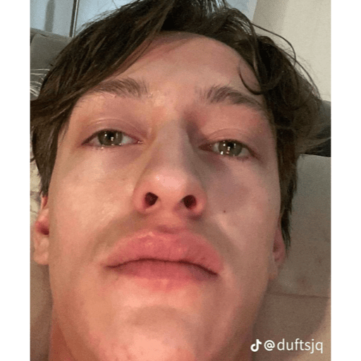 Que 29