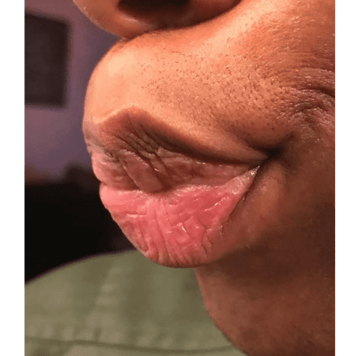 Lerolorelorey 25