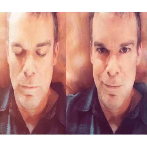 Albins reaction 30